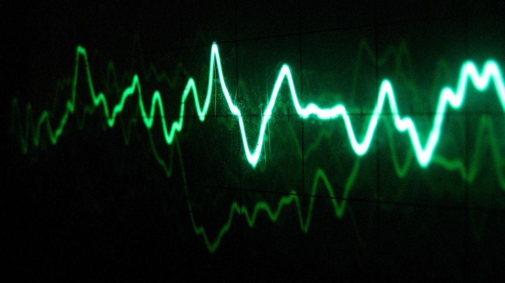 Voice Pattern Waveform